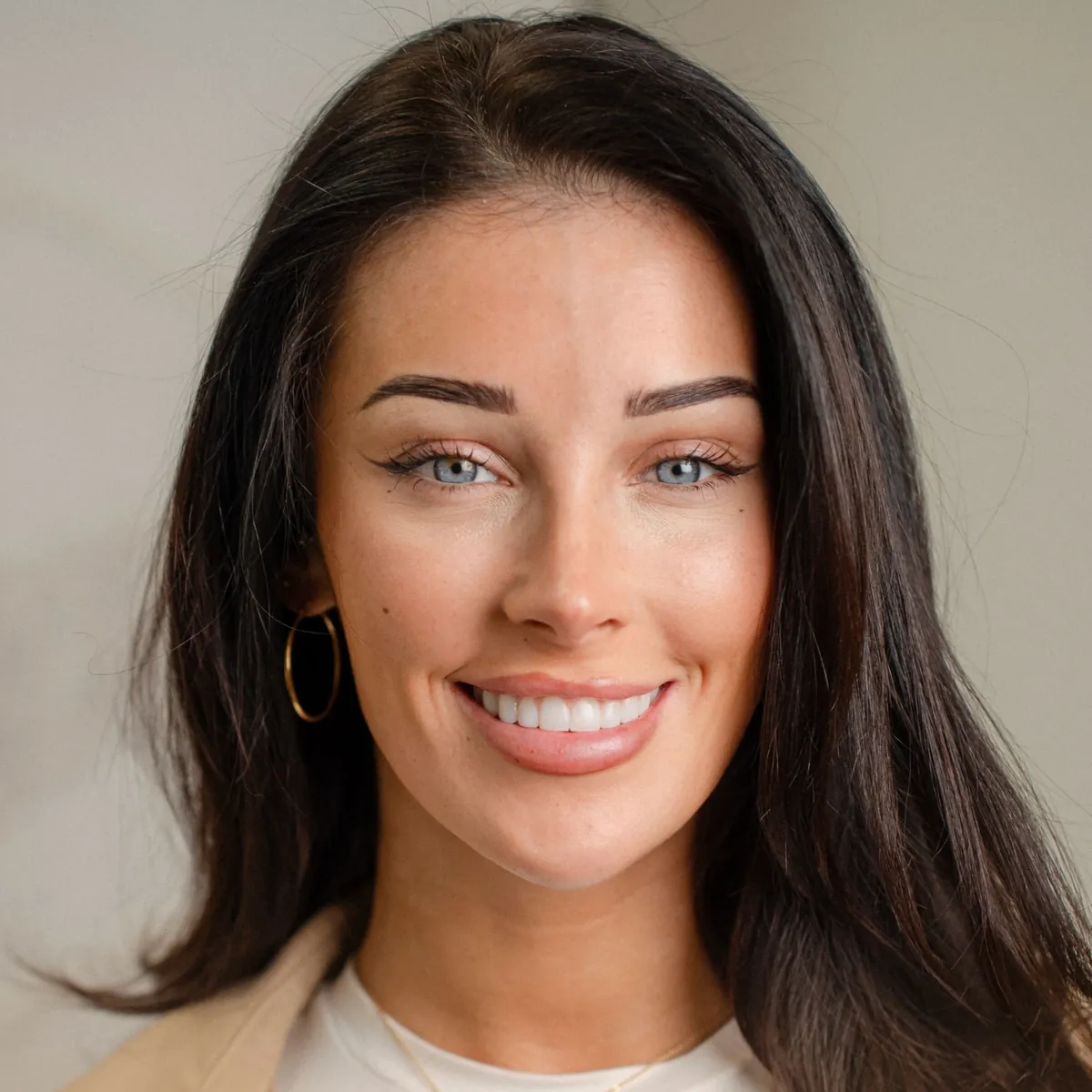 Aura patient smiling after her smile makeover