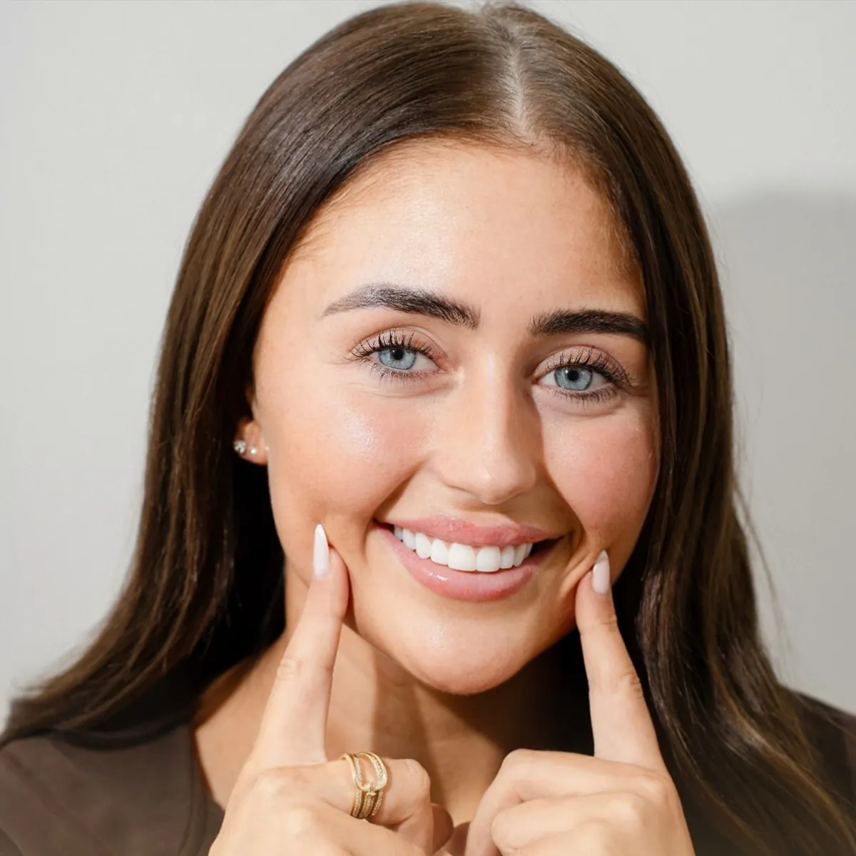 Aura patient showing her new smile