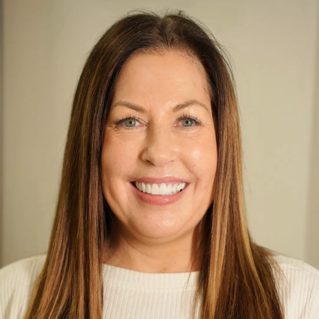 Aura dental implant patient smiling