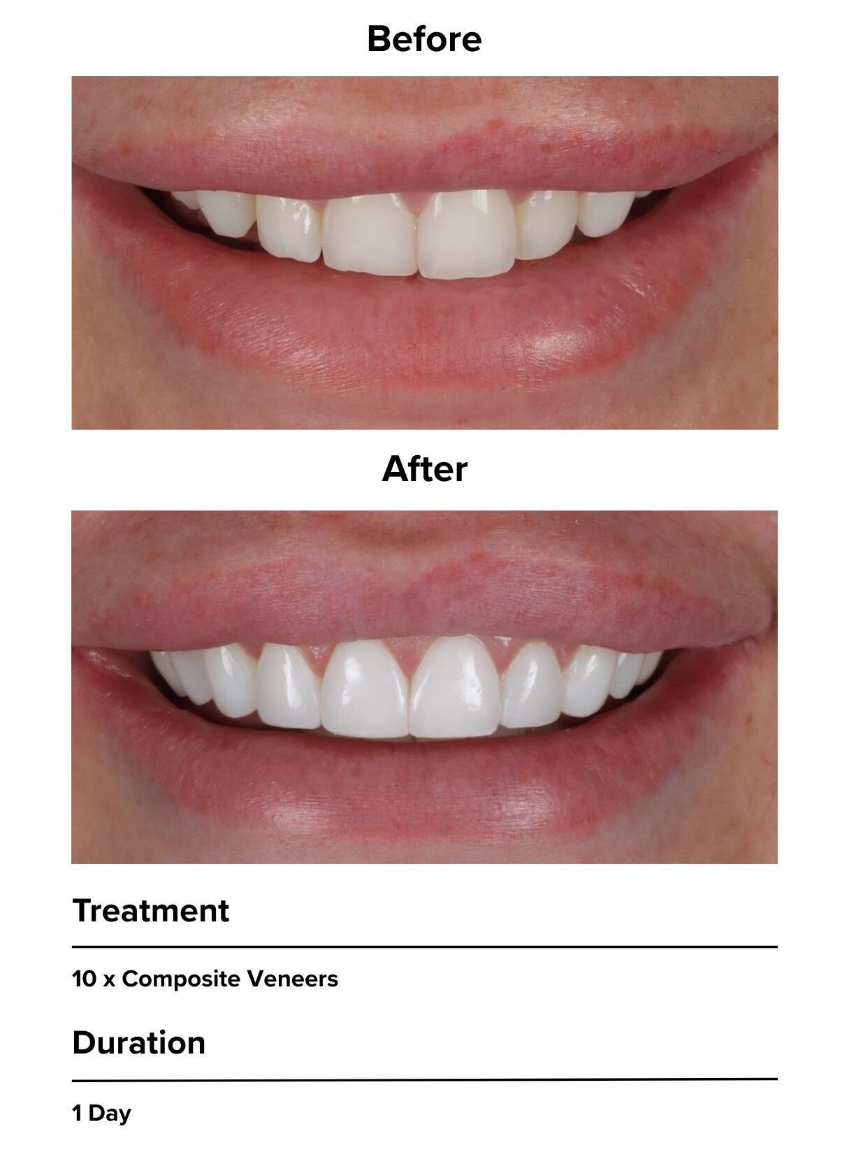 Patient smile makeover results