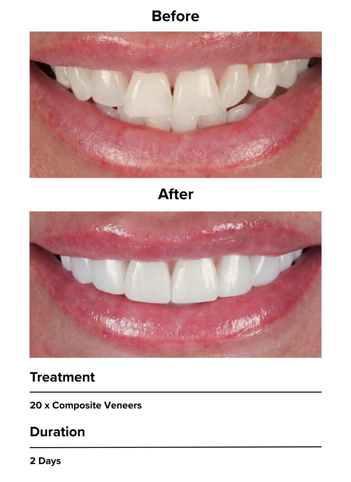 Dramatic smile transformation
