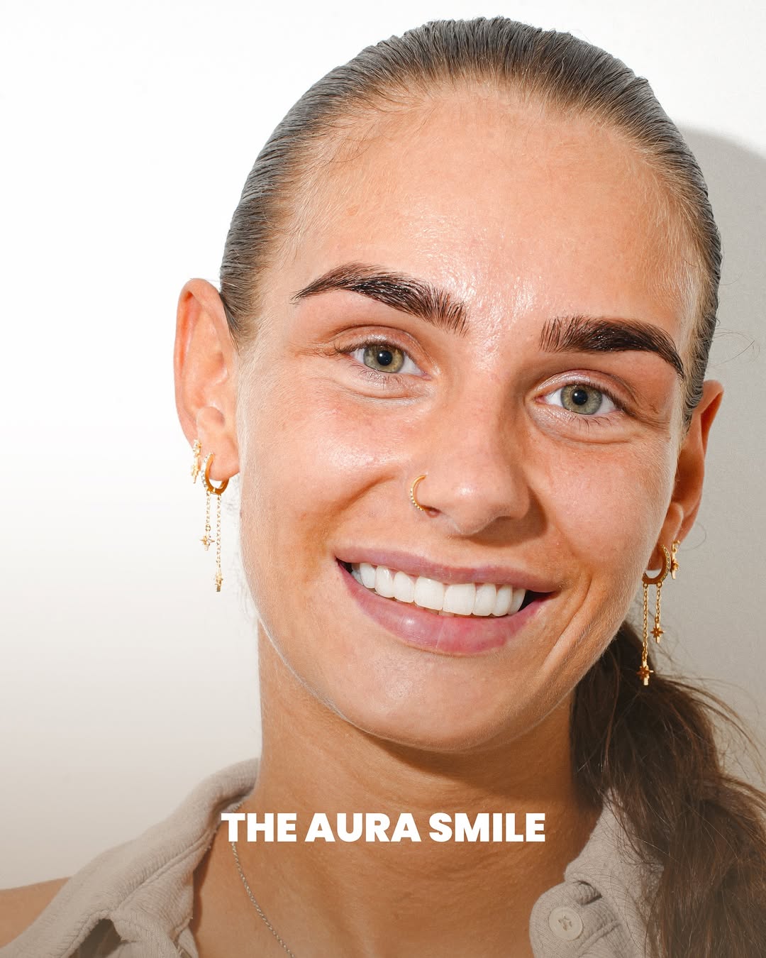Composite Bonding at Aura Dental Clinic