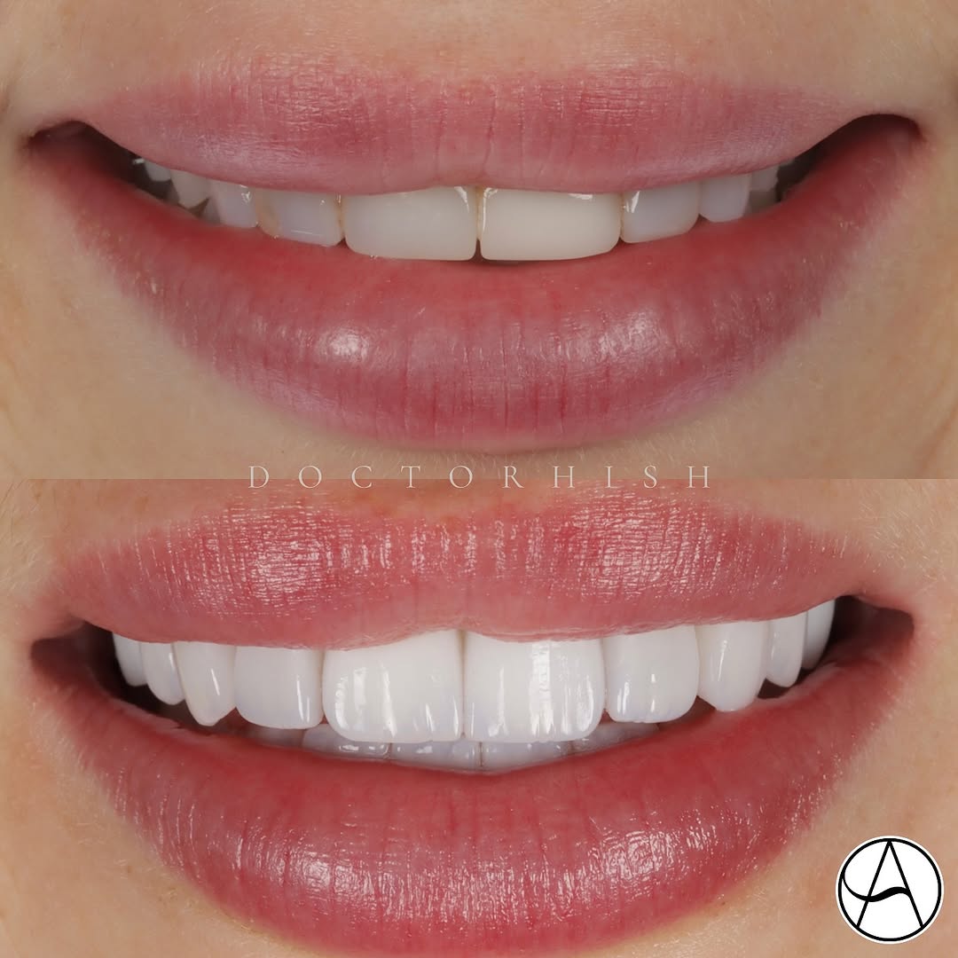 Case 2 — before & after