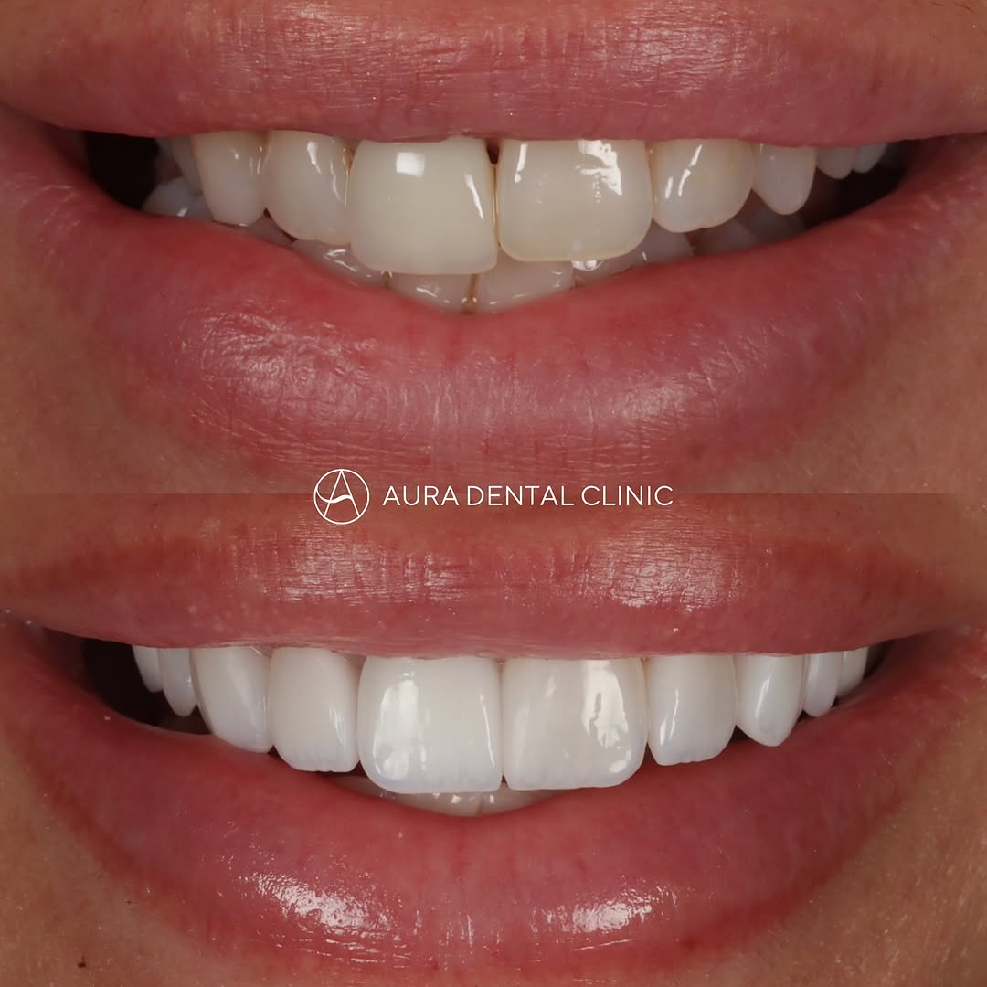 Case 3 — before & after