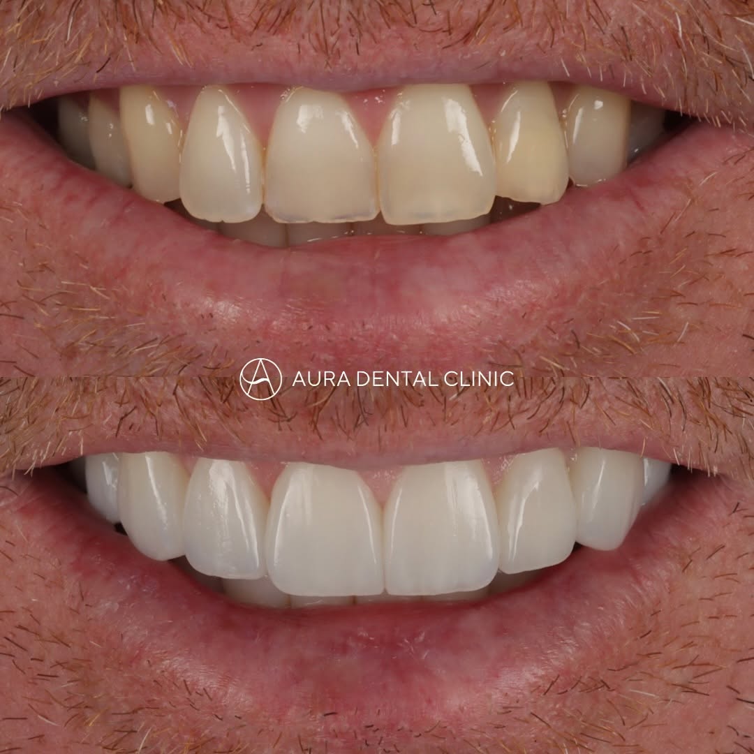 Case 1 — before & after