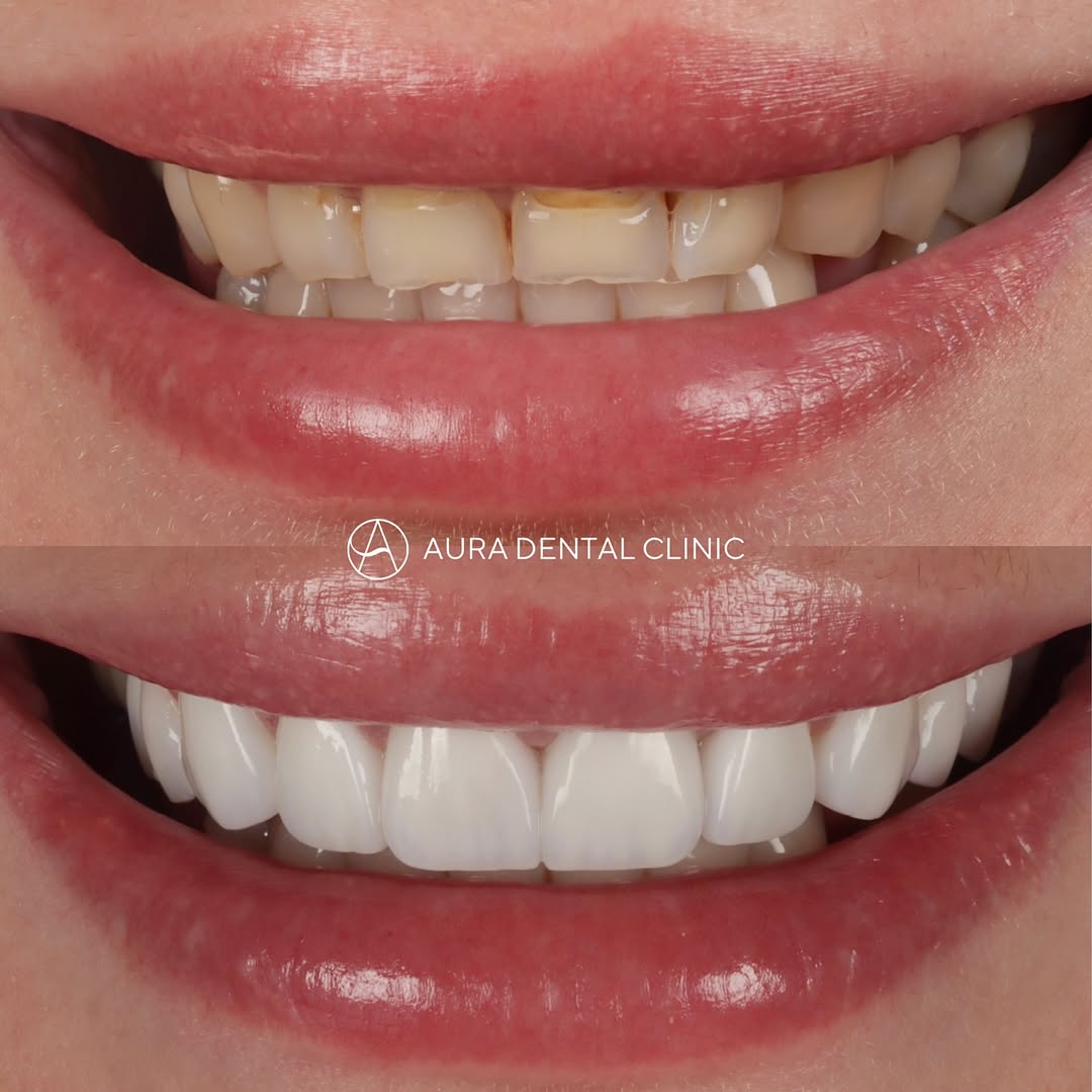 Case 6 — before & after